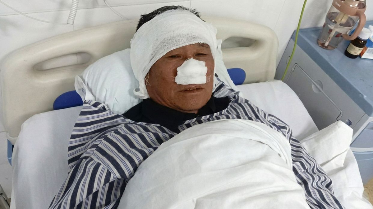 Chinese villager loses nose saving woman from attacker, named national hero