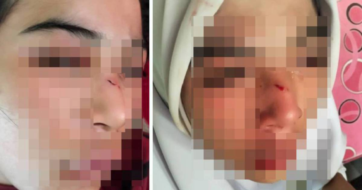 Kelantan Education Department Investigates Alleged Assault on Student Who Suffered Fractured Nose