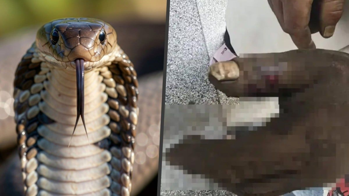 Woman Poisons Herself Trying to Save Husband from Cobra Bite in Yunnan