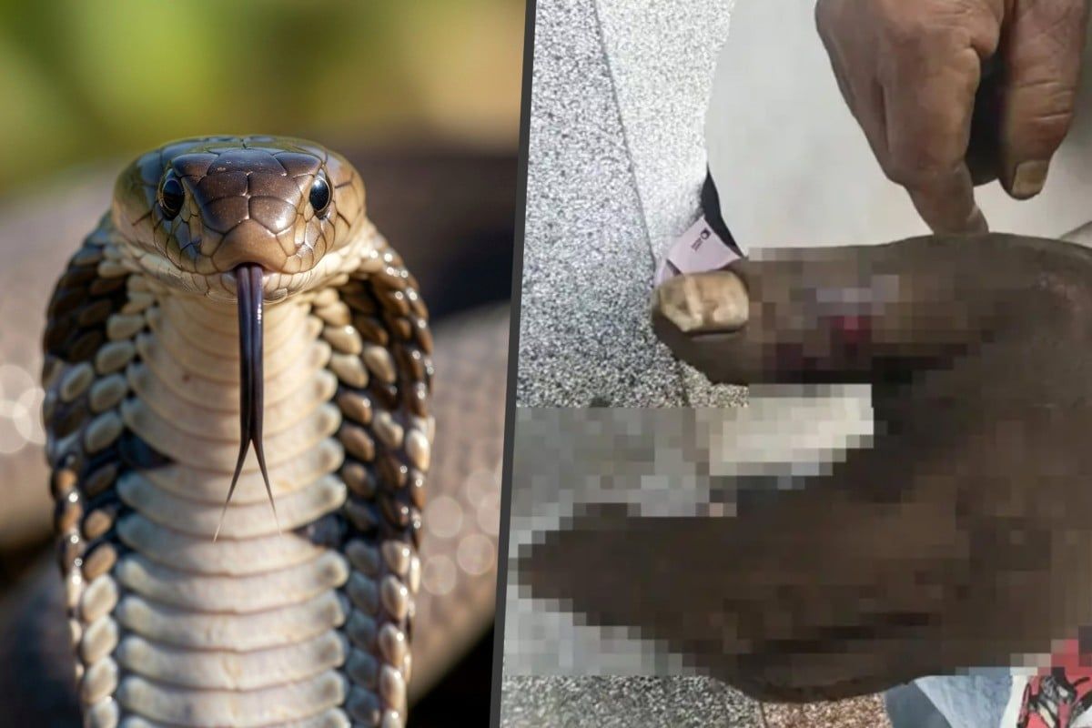 Woman Poisons Herself Trying to Save Husband from Cobra Bite in Yunnan