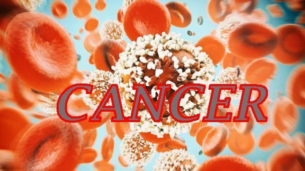 The Silent Crisis: Why Colorectal Cancer Is Striking Down Young People