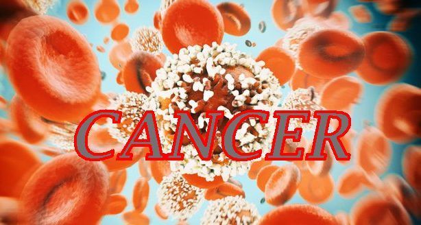 The Silent Crisis: Why Colorectal Cancer Is Striking Down Young People