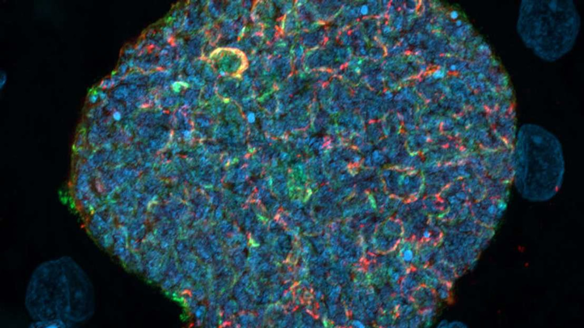 Australian Scientists Develop Malaria Vaccine That Uses Mosquito Bites as Natural Immune Boosters