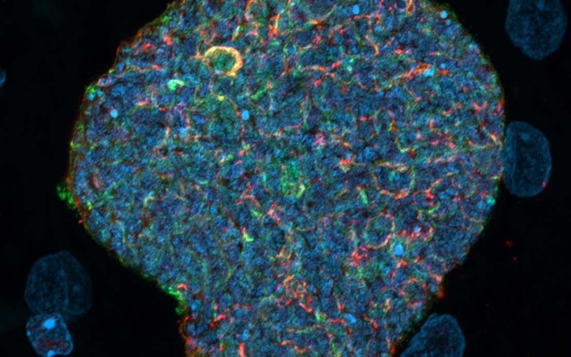 Australian Scientists Develop Malaria Vaccine That Uses Mosquito Bites as Natural Immune Boosters
